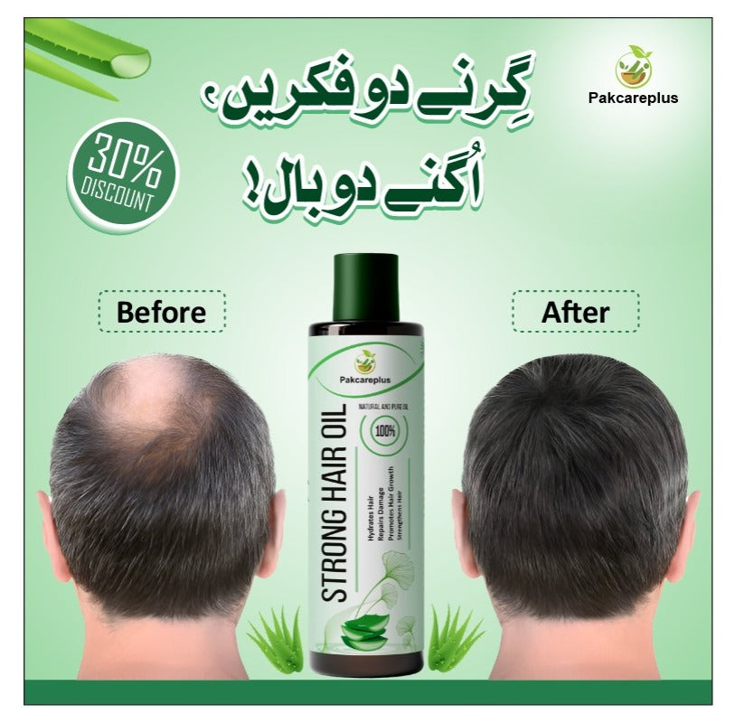 Hair Strong - The Multivitamin Oil For All Types Of Hairs - For  Both Man & woman - 200 ML